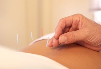 Memperkenalkan Akupunktur Sebagai Jalan Alternatif